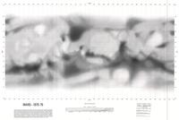 Mars 1975-76